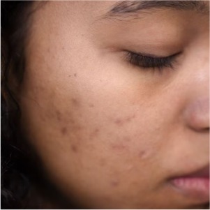 best derma doctor in Crossing Republik