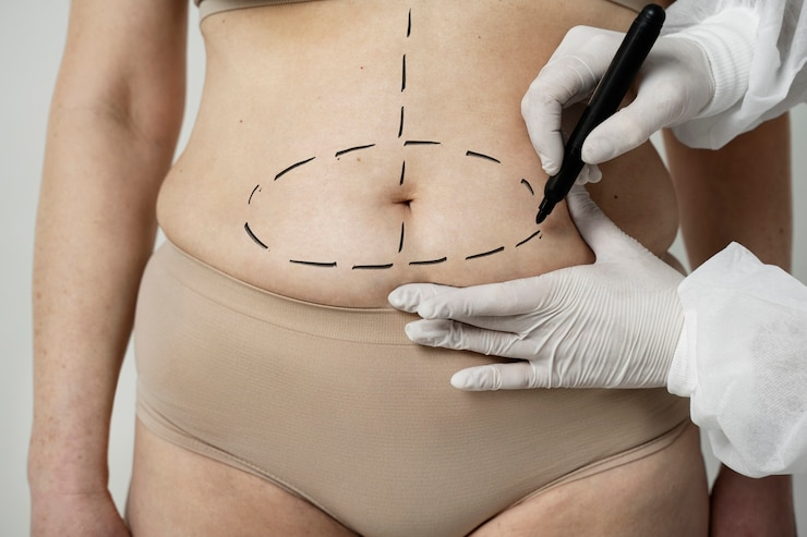 Best Plastic Surgeon in Greater Noida West